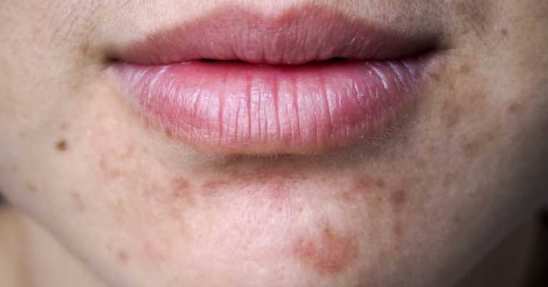 6 Foods That Could Change Your Skin