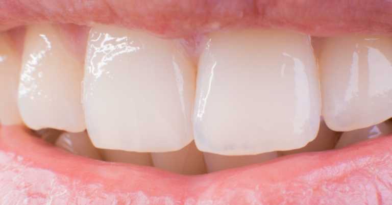 Use These Pantry Staples To Get Whiter Teeth