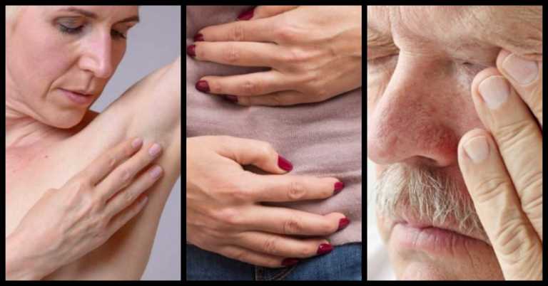 14 Commonly Ignored Cancer Symptoms Both Men And Women Should Never Overlook