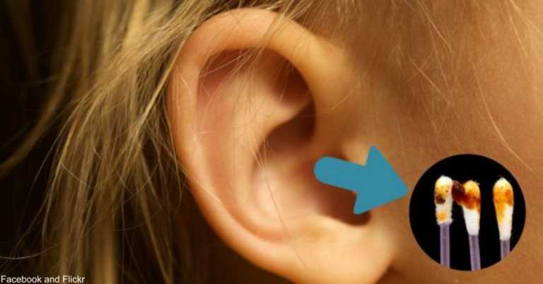 7 Health Issues Your Ears Can Reveal