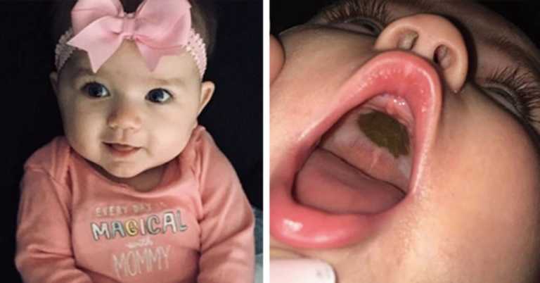 Mom Goes From Worried To Mortified After Finding Dark Brown Spot In Baby’s Mouth