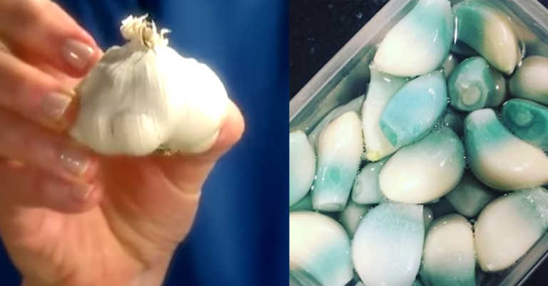 3 Common Mistakes People Make When Cooking With Garlic