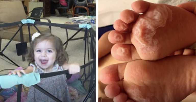 Toddler Gets 2nd-Degree Burns After Daycare Lets Her Go Outside Without Shoes
