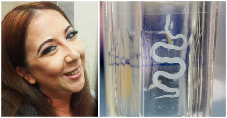 Doctors Think Woman Has A Brain Tumor, But Then They Open Her Skull And Find A Tapeworm Instead