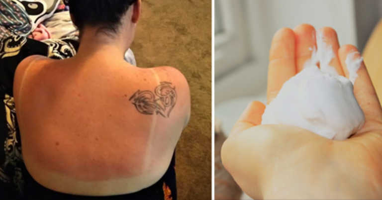 Mom Shares Genius Sunburn Hack Involving Shaving Cream In Detailed Facebook Post