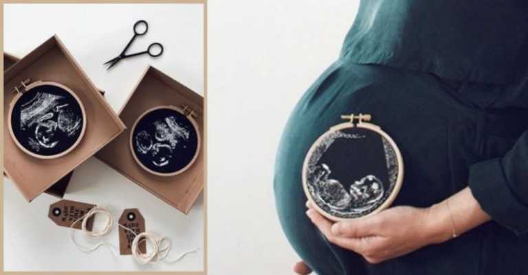 Mom Creates Beautiful Embroidered Keepsakes With Ultrasound Photos