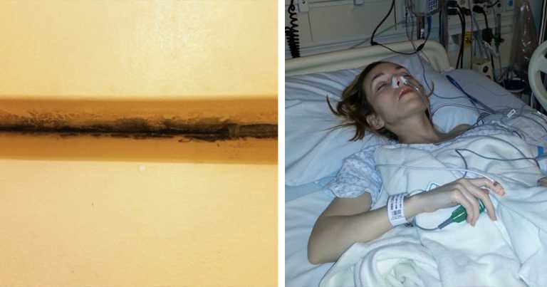 Black Mold Slowly Poisoned This Woman for 35 Years