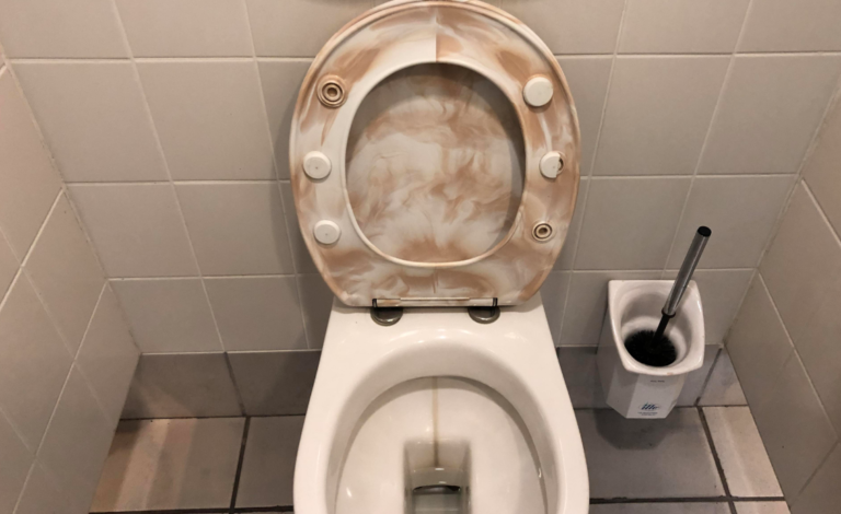 Is It Possible To Get Sick From A Toilet Seat?
