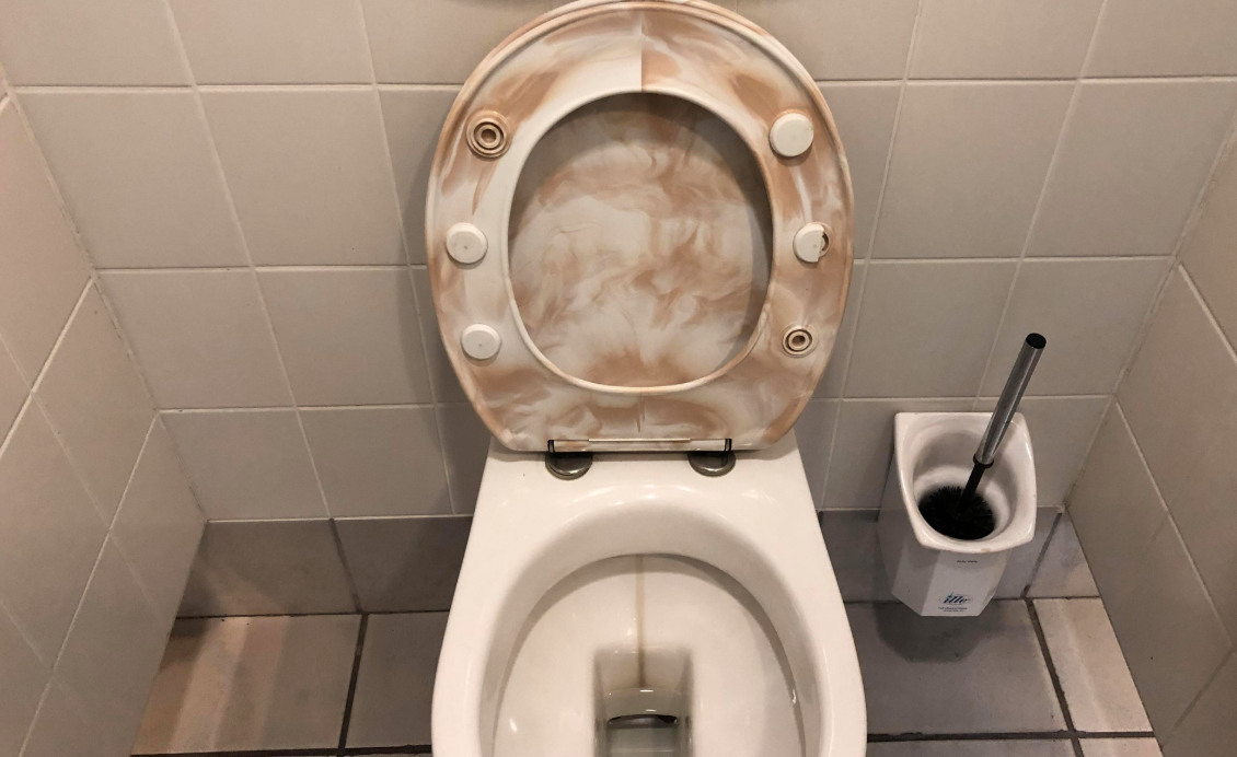 Is It Possible To Get Sick From A Toilet Seat? 12 Tomatoes