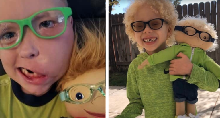 Woman Creates ‘Dolls Like Me’ To Make Kids With Disabilities Feel Included