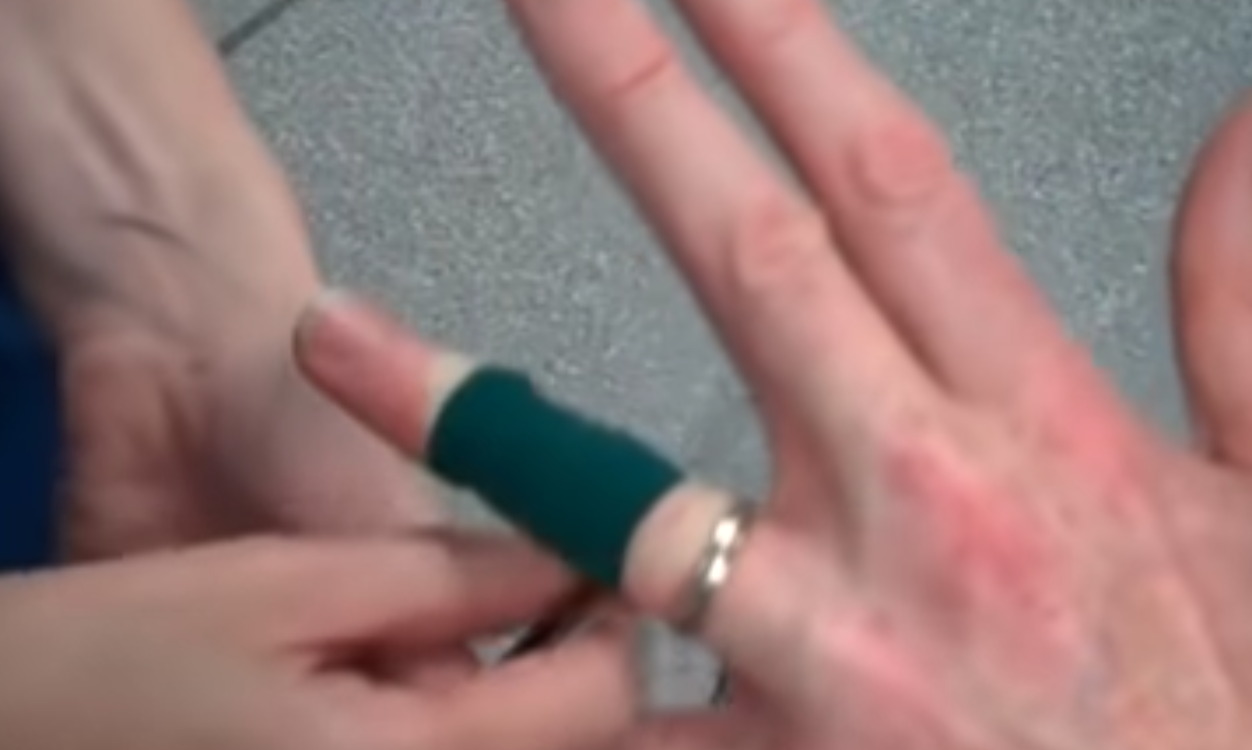 Pregnant woman forced to cut off wedding ring after eight years due to  swelling | The Independent