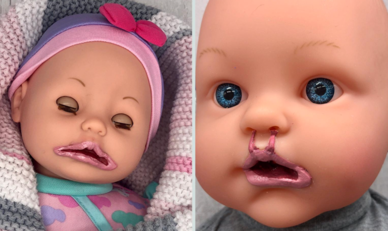 Mom Creates A Line Of Dolls For Children With Disabilities