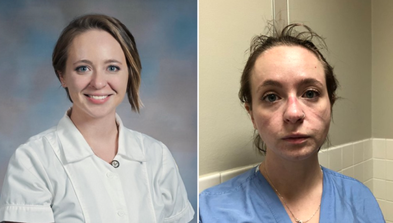 Nurse Posts ‘Before-And-After’ From The Past Year Of Working