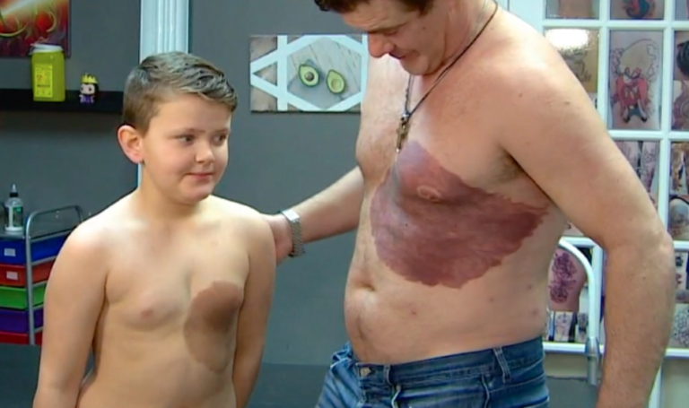 Dad Gets A Tattoo That Looks Like His Son’s Birthmark To Help Boost His Confidence