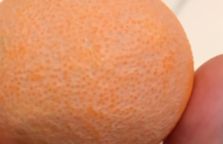 Cosmetic Doctor Explains Why You Shouldn’t Use Makeup Wipes