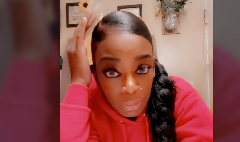Woman Uses Gorilla Glue In Place Of Hair Spray And Ends Up In The Hospital