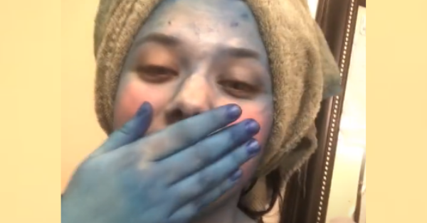 Teen’s Hair Fail Turns Her Whole Body Blue