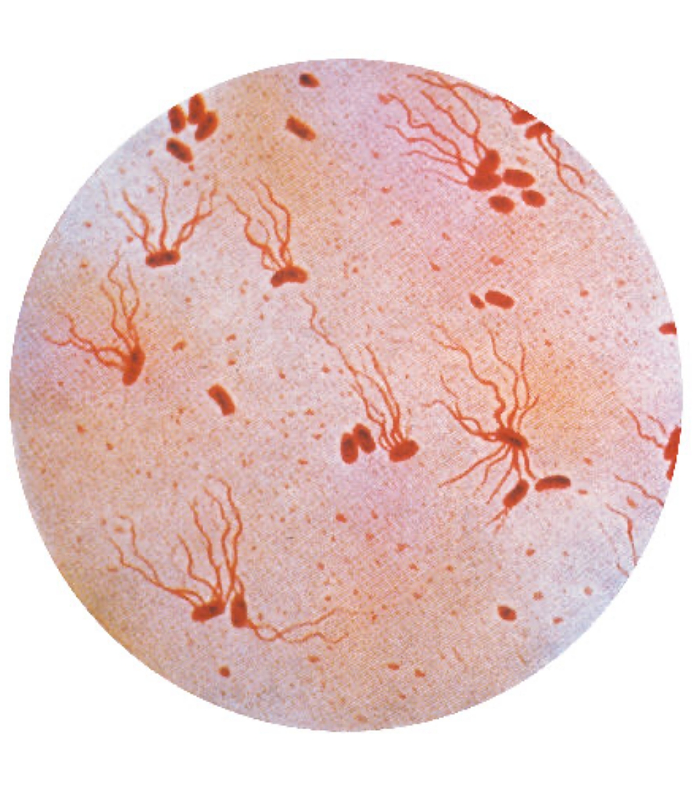 salmonella bacteria close up 