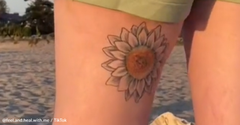 Woman Transforms ‘Unsightly’ Birthmark Into Beautiful Sunflower Tattoo