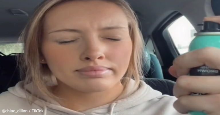 Girl Attempts Faux Freckles Hack With Hair Dye And It Goes Horribly Wrong