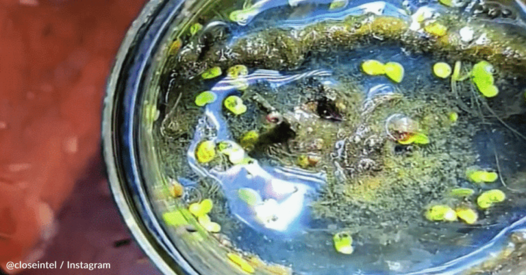 Scientists Examine Germs Vs Rubbing Alcohol Under A Microscope