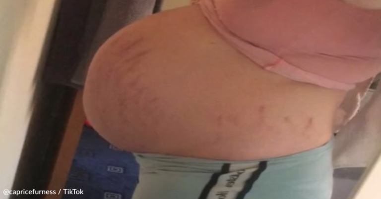 Mom Gives Birth To Baby The Size Of A Toddler