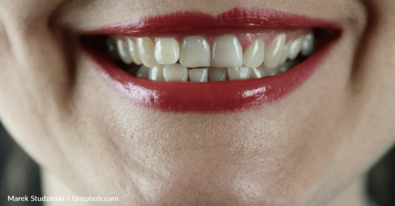 Dental Surgeon Warns Against Viral Teeth Hacks On TikTok