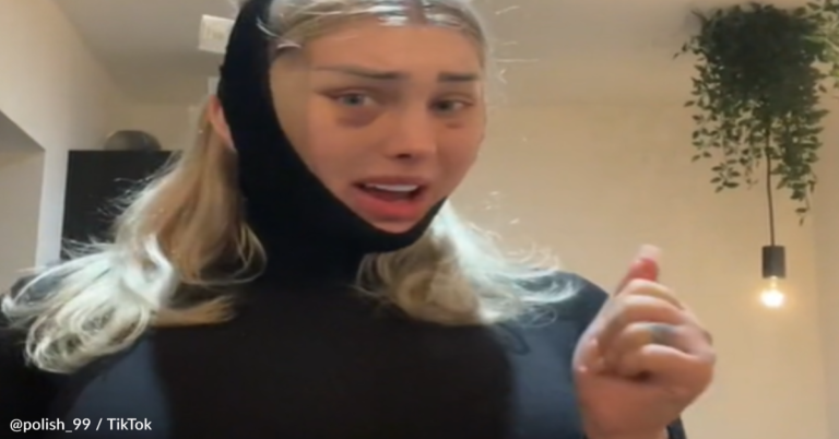 Woman Says Her Head “Exploded” On Flight After Getting Plastic Surgery