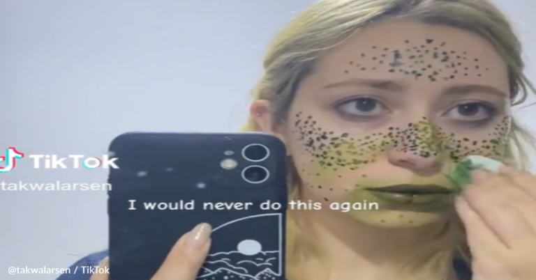 Woman’s Attempt To Create Fake Freckles With Henna Goes Horribly Wrong
