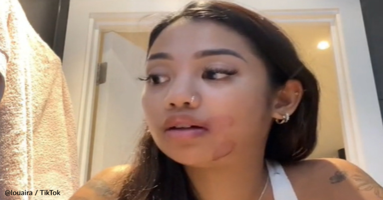 Woman Reveals What Can Happen When You Don’t Wash Your Makeup Brushes