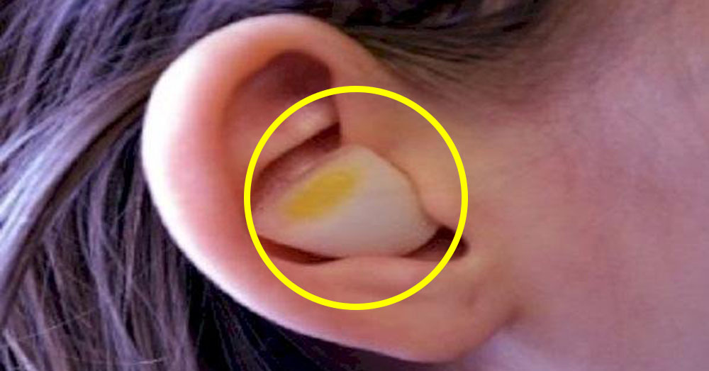 Here’s What Happens When You Put An Onion In Your Ear Overnight Page