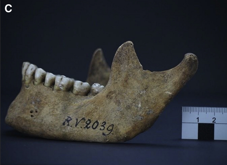RV 2039 skull from Latvia